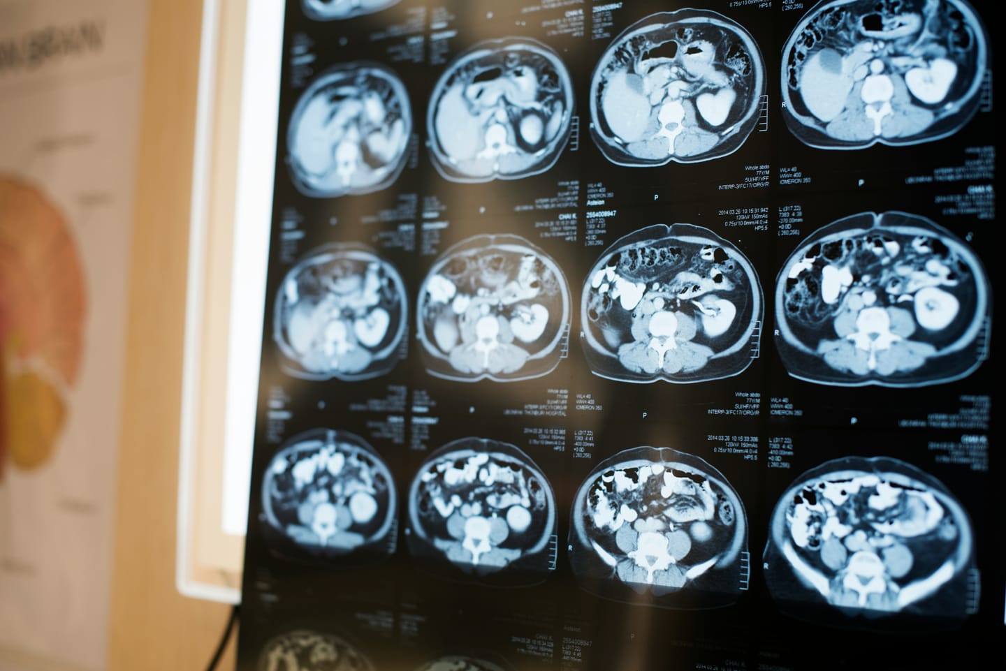 Benchmarking Claude 4 Sonnet and GPT-4o for Brain MRI Image Labelling: Comparing Chat Interface and API Results