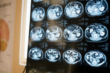 Benchmarking Claude 4 Sonnet and GPT-4o for Brain MRI Image Labelling: Comparing Chat Interface and API Results